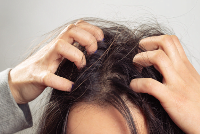4. Prevent Scalp Infections