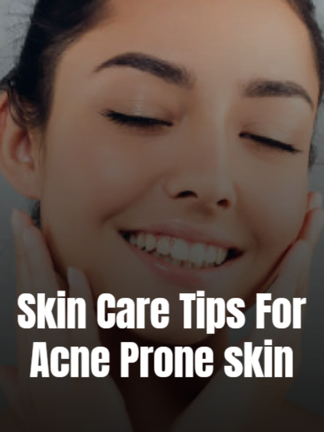Skin care tips for acne prone skin thumb