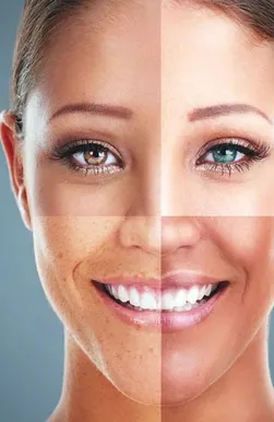 Skin Type