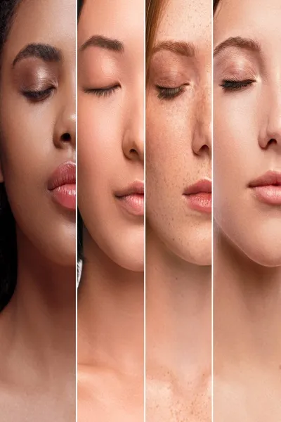 Skin Tone